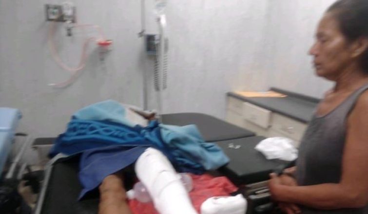Motociclista atropella a una mujer y la deja abandonada